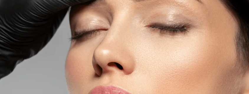 Femme recevant des injections d’acide hyaluronique chez un médecin esthétique à Paris