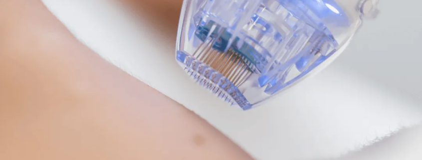 Machine radiofréquence microneedling soins esthétiques Paris médecin esthétique Paris Docteur Dominique Bellecour