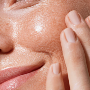 Femme texture peau unifiée radiofréquence microneedling soins esthétiques Paris médecin esthétique Paris Docteur Dominique Bellecour