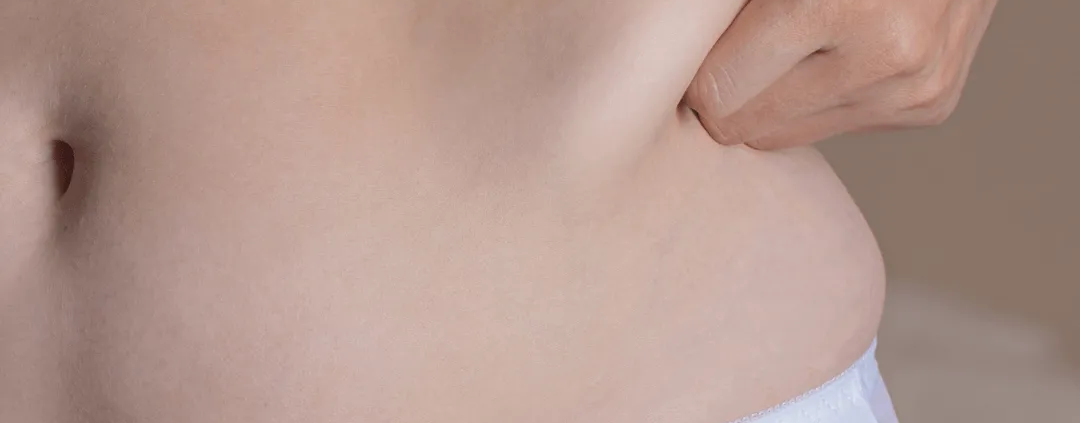 Femme souhaitant cryolipolyse poignées d amour soins esthétiques Paris médecin esthétique Paris Docteur Dominique Bellecour