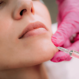 Femme recevant des injections d’acide hyaluronique dans le menton chez un médecin esthétique à Paris, Docteur Dominique Bellecour