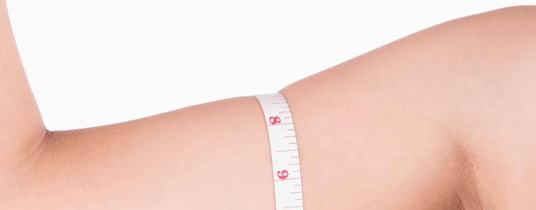 Femme souhaitant Coolwaves bras soins esthétiques Paris médecin esthétique Paris Docteur Dominique Bellecour