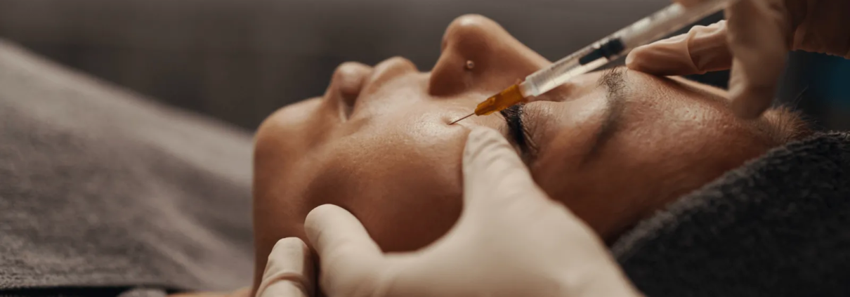 Femme résultats injection acide hyaluronique cernes docteur médecin esthétique Paris Dominique Bellecour