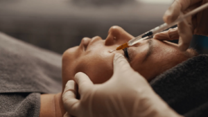 Femme résultats injection acide hyaluronique docteur médecin esthétique Paris Dominique Bellecour