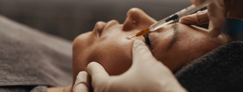 Femme résultats injection acide hyaluronique cernes docteur médecin esthétique Paris Dominique Bellecour