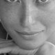 Gros plan sur la peau du visage, illustration du microneedling par radiofréquence